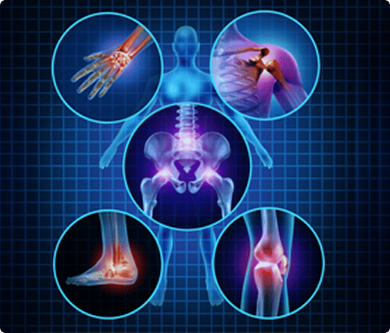 Tendonitis